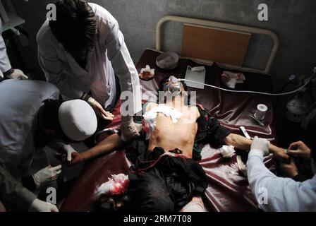 (140314) -- PESHAWAR, 14 marzo 2014 (Xinhua) -- un uomo ferito riceve cure mediche in un ospedale nel nord-ovest del Pakistan a Peshawar, 14 marzo 2014. Sette persone sono rimaste uccise e altre 25 ferite quando un'esplosione suicida ha colpito un veicolo della polizia vicino alla città nordoccidentale di Peshawar in Pakistan venerdì pomeriggio, hanno detto i media locali e la polizia. (Xinhua/Umar Qayyum) PAKISTAN-PESHAWAR-BLAST-HOSPITAL PUBLICATIONxNOTxINxCHN Peshawar 14 marzo 2014 XINHUA all'uomo ferito riceve cure mediche IN un ospedale nel nord-ovest del Pakistan di Peshawar 14 marzo 2014 sette celebrità sono state UCCISE e altri 25 feriti Wh Foto Stock