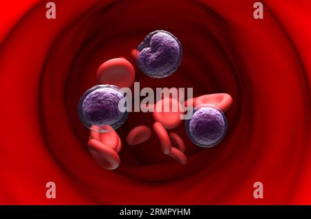 Linfoma non-hodgkin cellule NHL nel flusso sanguigno - vista in sezione illustrazione 3d. Foto Stock