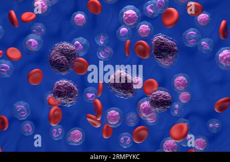 Cellule di linfoma non-hodgkin (NHL) nel flusso sanguigno - vista isometrica 3D illustrazione Foto Stock