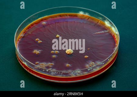 Capsula di Petri con colonie di microrganismi in un laboratorio medico Foto Stock