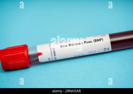 Basic Metabolic Panel (BMP) This Test measures various electrolytes and other chemicals in the blood, including glucose, calcium, sodium, and potassiu Stock Photo