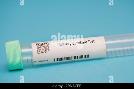 Salivary Cytokine Test This test measures the levels of cytokines, proteins that are involved in the body's immune response, in the saliva. It is used Stock Photo