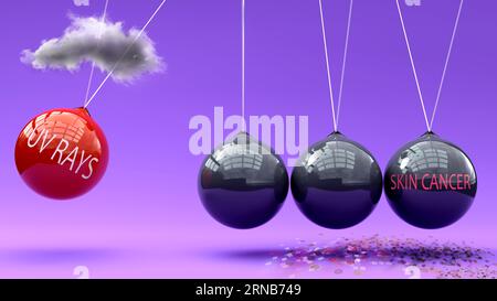 I raggi UV portano al cancro della pelle. Una metafora a culla di Newton in cui i raggi uv mettono ripetutamente in movimento il cancro della pelle. Relazione causa-effetto tra. Vici Foto Stock