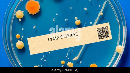 Lyme disease - Bacterial infection transmitted by ticks and can cause fever, joint pain, and a characteristic rash. Stock Photo