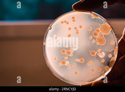 Capsula di Petri con colonie di microrganismi in un laboratorio medico Foto Stock