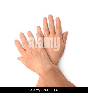 Vista ravvicinata delle mani di una donna con la pelle che invecchia, vista dall'alto Foto Stock