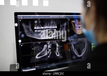 211107 -- SHANGHAI, 7 novembre 2021 -- foto scattata il 7 novembre 2021 mostra la tecnologia di imaging digitale applicata alla chirurgia odontoiatrica presso l'area espositiva Medical Equipment and Healthcare Products del 4° China International Import Expo CIIE nella Shanghai orientale della Cina. CIIECHINA-SHANGHAI-CIIE-EXHIBITION-DIGITAL TECHNOLOGY CN JINXLIWANG PUBLICATIONXNOTXINXCHN Foto Stock