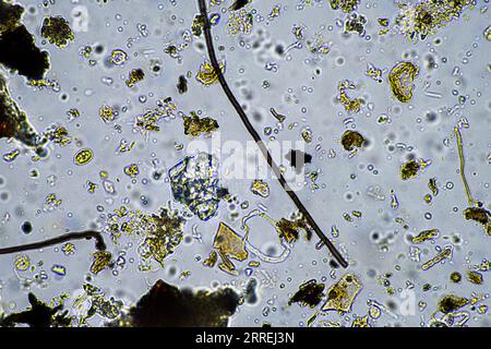 vita del suolo al microscopio con funghi del suolo e ifi fungine in un'azienda agricola Foto Stock