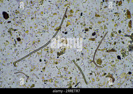 vita del suolo al microscopio con funghi del suolo e ifi fungine in un'azienda agricola Foto Stock