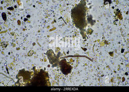 vita del suolo al microscopio con funghi del suolo e ifi fungine in un'azienda agricola Foto Stock