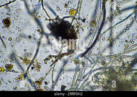 vita del suolo al microscopio con funghi del suolo e ifi fungine in un'azienda agricola Foto Stock