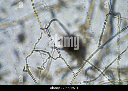 vita del suolo al microscopio con funghi del suolo e ifi fungine in un'azienda agricola Foto Stock