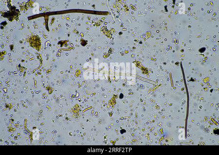 vita del suolo al microscopio con funghi del suolo e ifi fungine in un'azienda agricola Foto Stock