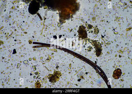vita del suolo al microscopio con funghi del suolo e ifi fungine in un'azienda agricola Foto Stock