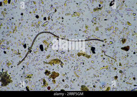 vita del suolo al microscopio con funghi del suolo e ifi fungine in un'azienda agricola Foto Stock