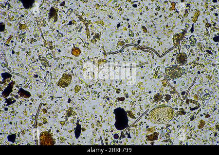 vita del suolo al microscopio con funghi del suolo e ifi fungine in un'azienda agricola Foto Stock