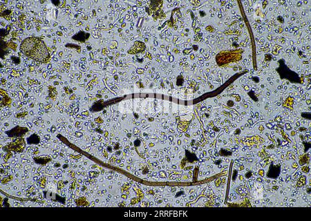 vita del suolo al microscopio con funghi del suolo e ifi fungine in un'azienda agricola Foto Stock