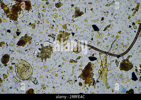 vita del suolo al microscopio con funghi del suolo e ifi fungine in un'azienda agricola Foto Stock