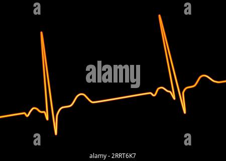 Ritmo cardiaco sano, illustrazione Foto Stock