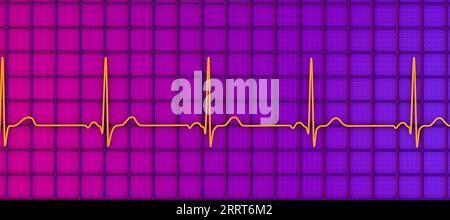 Ritmo cardiaco sano, illustrazione Foto Stock