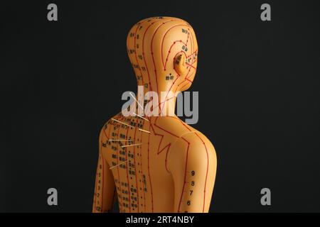 Agopuntura - medicina alternativa. Modello umano con aghi sul retro su sfondo nero Foto Stock