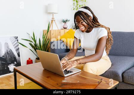 Giovane studentessa con la vitiligine che studia su un computer portatile seduto sul divano a casa Foto Stock