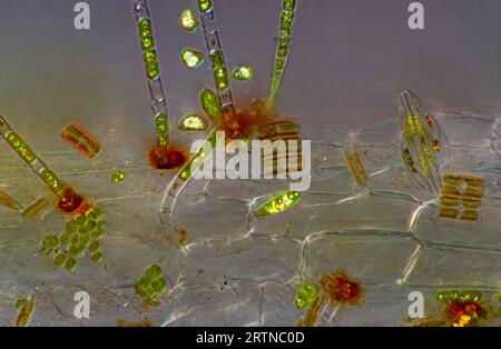 L'immagine presenta varie piccole alghe adagiate su Lemna sp. Root, fotografata attraverso il microscopio con luce polarizzata a un ingrandimento di 200X. Foto Stock