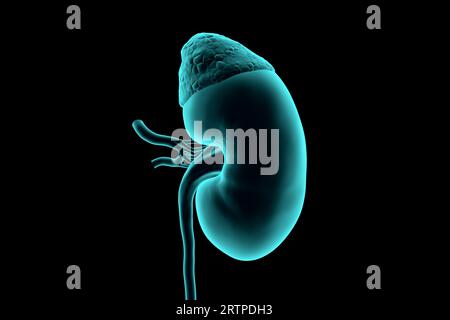 illustrazione 3d di una simulazione realistica dei raggi x del rene umano isolata sul nero Foto Stock
