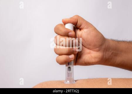 foto dell'iniezione di penna diabetica sulla pelle Foto Stock