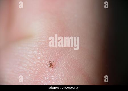 Zecca ninfa che cammina sulla pelle umana (Ixodes), un parassita nel Regno Unito che può causare la malattia di Lyme Foto Stock