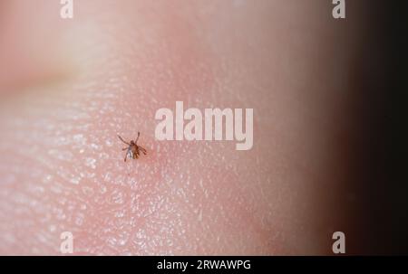 Zecca ninfa che cammina sulla pelle umana (Ixodes), un parassita nel Regno Unito che può causare la malattia di Lyme Foto Stock