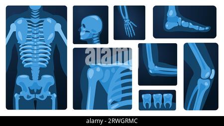 Parti del corpo radiogeno. Scheletro umano ginocchio braccio torace polso piede, concetto di imaging radiografico medico della lesione ossea. Serie piatta vettoriale Illustrazione Vettoriale