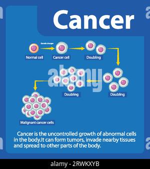 Comprendere lo sviluppo e l'elaborazione delle cellule tumorali attraverso un'infografica Illustrazione Vettoriale