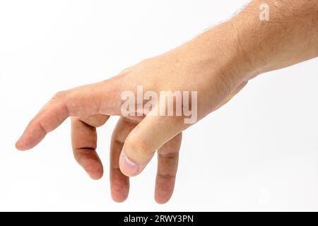 mano maschile, asciutta e con macchie cutanee, problema dermatologico, inizio della melanosi solare, pelle senza protezione solare, isolata su sfondo bianco, Foto Stock