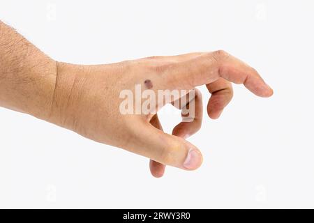 mano maschile, asciutta e con macchie cutanee, problema dermatologico, inizio della melanosi solare, pelle senza protezione solare, isolata su sfondo bianco, Foto Stock