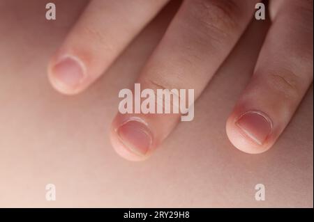 Tema pedicure per bambini. Piccolo dito con unghie minuscole Foto Stock