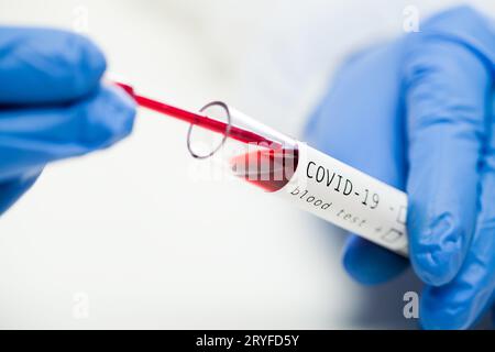 Closeup provetta di laboratorio contenente il sangue del paziente infetto da COVID-19 Foto Stock