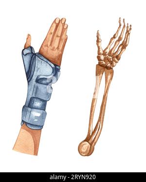 Acquerello Illustrazione di persona di aiuto di firs con la mano ferita, braccio bendato. Cliente fisioterapico. Foto Stock