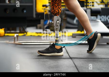 Giovane donna con una gamba protesica con esercizio fisico camminando su un tapis roulant per esercitarsi a camminare con l'altra gamba protesica Foto Stock