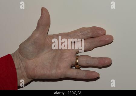 Primo piano dettagliato della mano completamente aperta di una donna anziana, evidenziando la pelle ruvida e il processo di invecchiamento naturale con tutte le dita rivolte contro un su Foto Stock