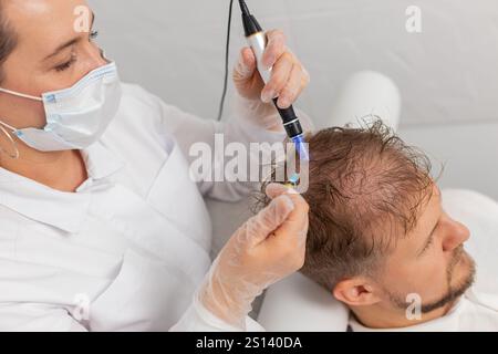 Alopecia. Perdita di capelli uomo migliorare la rigenerazione del trattamento di crescita, iniezioni di siringhe di dermapen microneedling vitamina esosomi. Cosmetologo tricologo medico procedura cuoio capelluto mesoterapia frazionaria Foto Stock