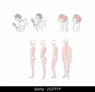 Posizione corretta e errata del collo dritto Foto Stock