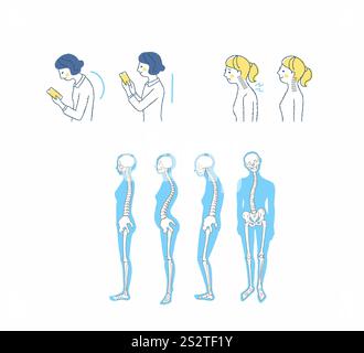 Posizione corretta e errata del collo dritto Foto Stock