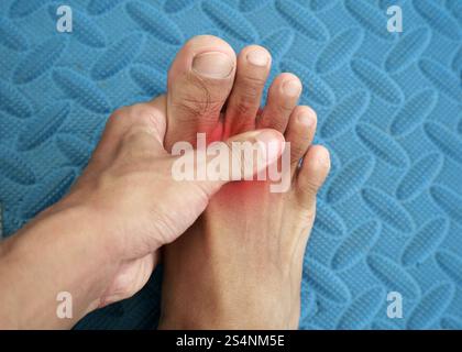 Le dita di un uomo che soffre di gotta, la zona dolorosa evidenziata in rosso Foto Stock