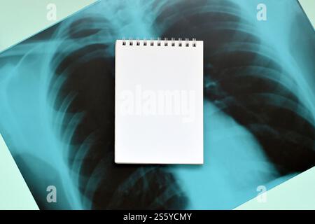 Immagine radiografica del torace umano per una diagnosi medica e pagina vuota del blocco note sul tavolo blu dell'ospedale. Composizione della vista dall'alto in posizione piatta con copia Foto Stock