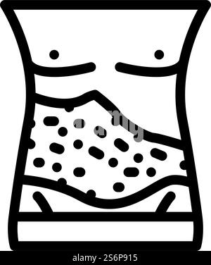 vettoriale icona della linea malattia della pelle dell'herpes zoster. segno di malattia della pelle di sant'antonio. illustrazione nera del simbolo del contorno isolato. illustrazione vettoriale dell'icona della linea della malattia della pelle dell'herpes zoster Illustrazione Vettoriale