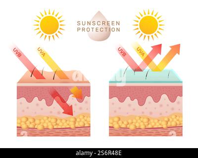 Protezione UV della pelle. Buccia della pelle umana danneggiata prima e dopo la protezione solare strati adiposi del corpo epidermide modello infografico vettoriale recente. Illustrazione delle scottature UV, dei danni alla carrozzeria dovuti ai raggi ultravioletti. Protezione UV della pelle. Buccia della pelle umana danneggiata prima e dopo la protezione solare strati adiposi del corpo epidermide modello infografico vettoriale recente Illustrazione Vettoriale