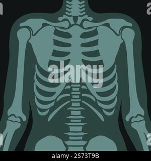Torace roentgen, scansione a raggi X di paziente con malattie respiratorie. Ospedale e cliniche assistenza sanitaria e trattamento delle malattie, diagnostica e analisi dei risultati. Immagine vettoriale in stile piatto. Raggi X di polmoni e costole, vettore di scansione sanitaria Illustrazione Vettoriale