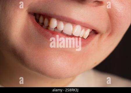 Primo piano ritratto di donna sorridente con denti bianchi. Sorriso naturale. Sorriso toothy. Foto Stock