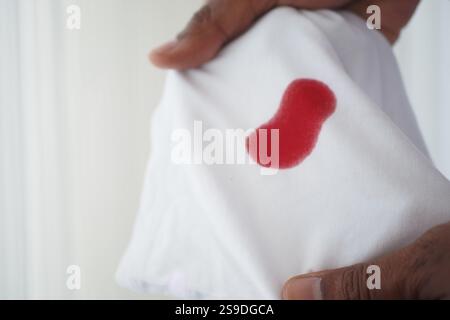 macchie di sangue su una camicia bianca. Foto Stock